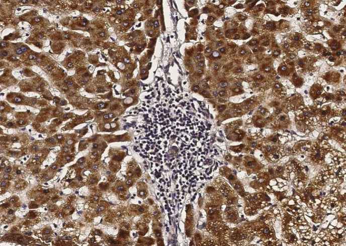 Anti-Human ACOX1 Antibody [B148] - ABMIUM
