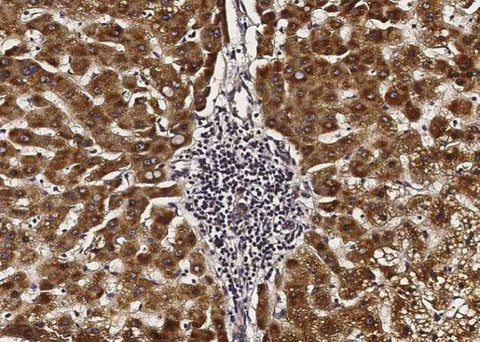 Anti-Human ACOX1 Antibody [B148] - ABMIUM