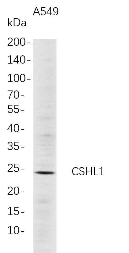 Anti-Human CSHL1 Antibody [B689] - ABMIUM