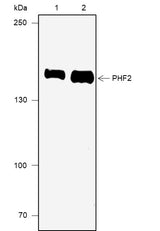 Anti-Human PHF2 Antibody [A668] - ABMIUM