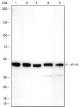 Anti-Human/Rat/Mouse ATG4B Antibody [A447]