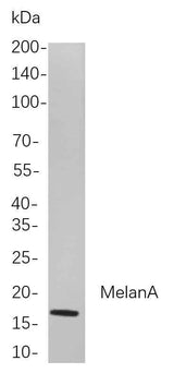 Anti-Human/Mouse MelanA Antibody [B863]