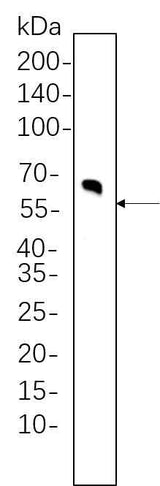 Anti-Human/Mouse/Rat/Monkey Tyrosine Hydroxylase Antibody [B1061]