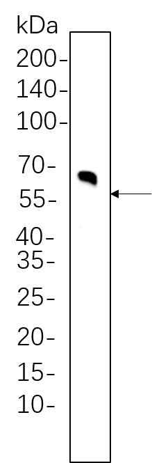 Anti-Human/Mouse/Rat/Monkey Tyrosine Hydroxylase Antibody [B1061] - ABMIUM