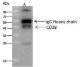Anti-Human CD38 Antibody [A1124] - ABMIUM