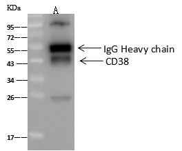Anti-Human CD38 Antibody [A1124] - ABMIUM