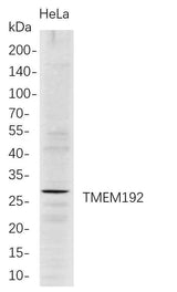Anti-Human TMEM192 Antibody [B704]
