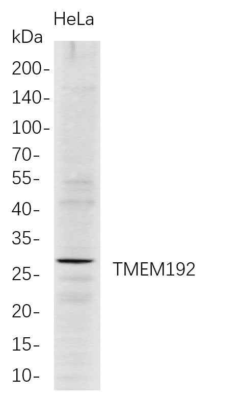 Anti-Human TMEM192 Antibody [B704] - ABMIUM