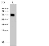 Anti-Human KRT7 Antibody [A1224] - ABMIUM