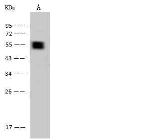 Anti-Human KRT7 Antibody [A1224] - ABMIUM