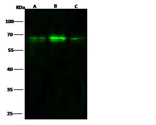 Anti-Human ARID3B Antibody [A1282] - ABMIUM