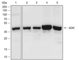 Anti-Human/Rat/Mouse ADK Antibody [A564]
