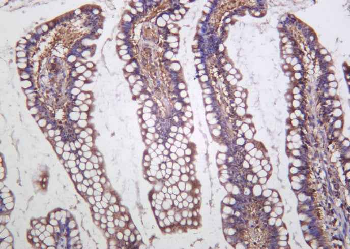 Anti-Human Cystathionase Antibody [B1016] - ABMIUM