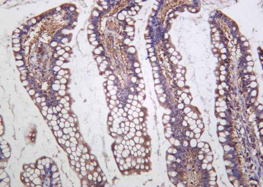 Anti-Human Cystathionase Antibody [B1016] - ABMIUM