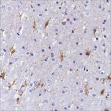 Anti-Human S100A13 Antibody [A353]