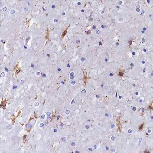 Anti-Human S100A13 Antibody [A353] - ABMIUM