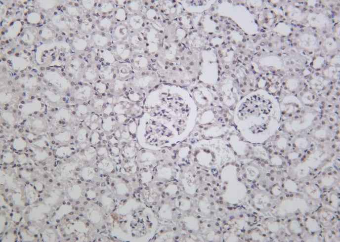 Anti-Human/Mouse/Rat BRD4 Antibody [B948] - ABMIUM