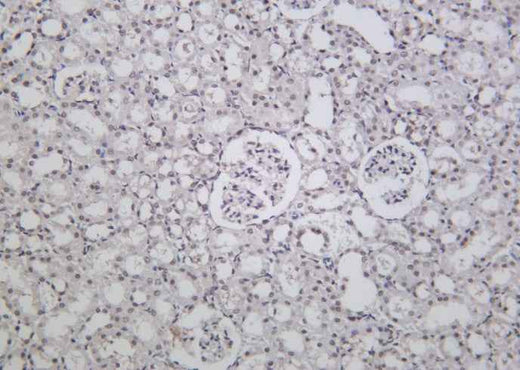 Anti-Human/Mouse/Rat BRD4 Antibody [B948] - ABMIUM