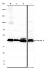 Anti-Human/Mouse Keratin 20 Antibody [A276]