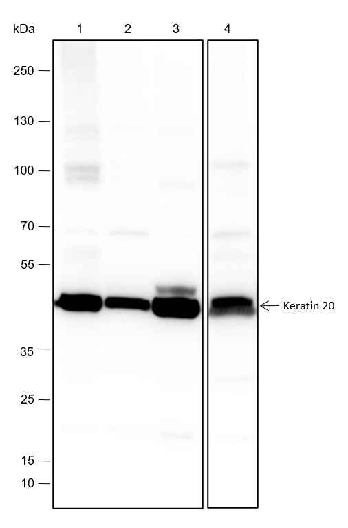 Anti-Human/Mouse Keratin 20 Antibody [A276]
