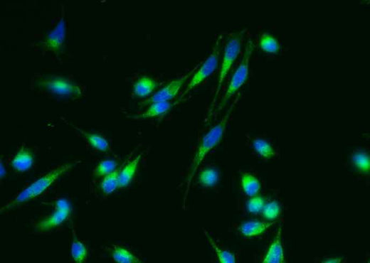 Anti-Human NCSTN Antibody [B316] - ABMIUM
