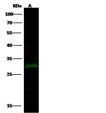 Anti-Human PRTFDC1 Antibody [A987] - ABMIUM
