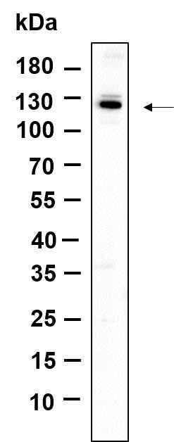 Anti-Human/Mouse/Rat Dnmt3a Antibody [B945]
