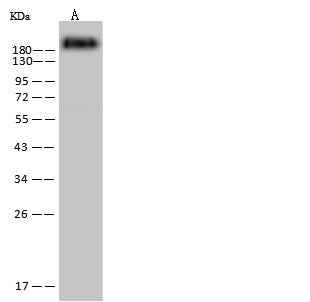 Anti-Human PTPRC Antibody [A1022] - ABMIUM