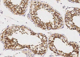 Anti-Human GDF3 Antibody [B216]