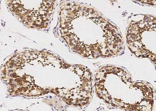 Anti-Human GDF3 Antibody [B216] - ABMIUM