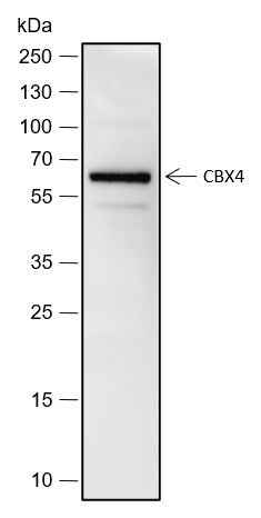Anti-Human/Rat/Mouse CBX4 Antibody [A527]