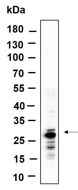 Anti-Human MTCO2 Antibody [B858] - ABMIUM