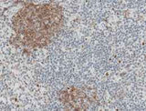 Anti-Human FCGR2B Antibody [B232]