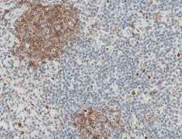 Anti-Human FCGR2B Antibody [B232] - ABMIUM