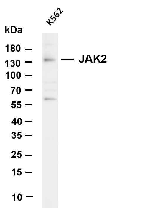 Anti-Human/Mouse/Rat JAK2 Antibody [B801] - ABMIUM