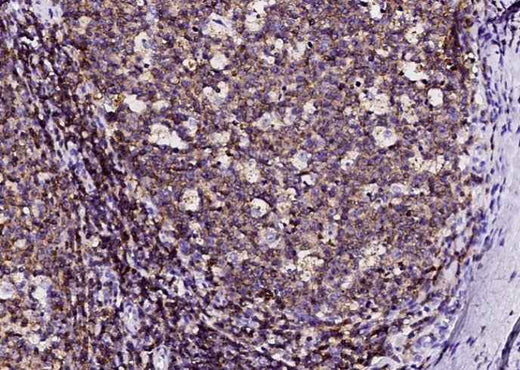 Anti-Human SLAMF6 Antibody [A1131] - ABMIUM