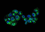 Anti-Human APOA1 Antibody [A894] - ABMIUM