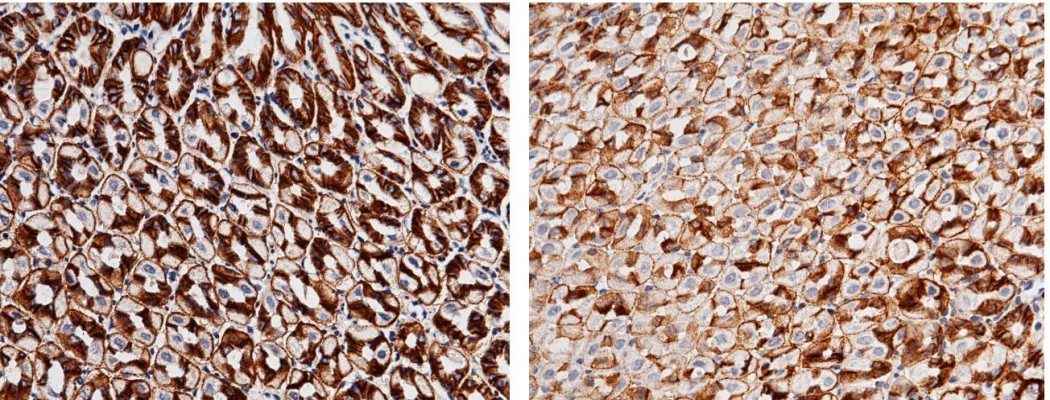 Anti-Mouse CA9 Antibody [B472] - ABMIUM