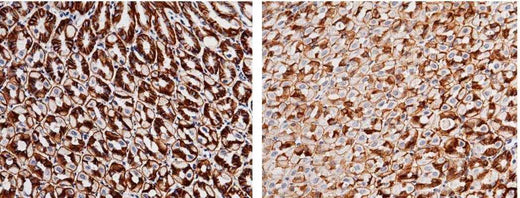 Anti-Mouse CA9 Antibody [B472] - ABMIUM