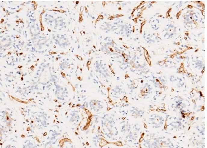 Anti-Human CD36 Antibody [A956] - ABMIUM