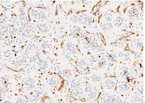 Anti-Human CD36 Antibody [A956] - ABMIUM