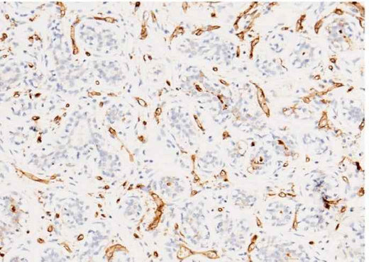 Anti-Human CD36 Antibody [A956] - ABMIUM