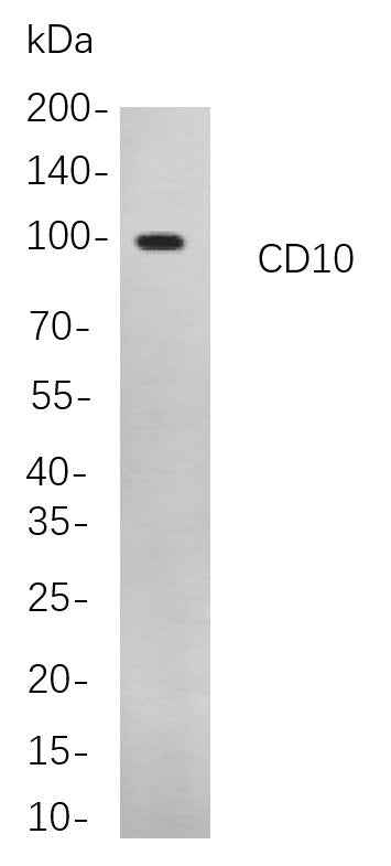 Anti-Human/Mouse/Rat CD10 Antibody [B788] - ABMIUM
