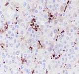 Anti-Human/Rat/Mouse Hemoglobin Alpha Antibody [A244]