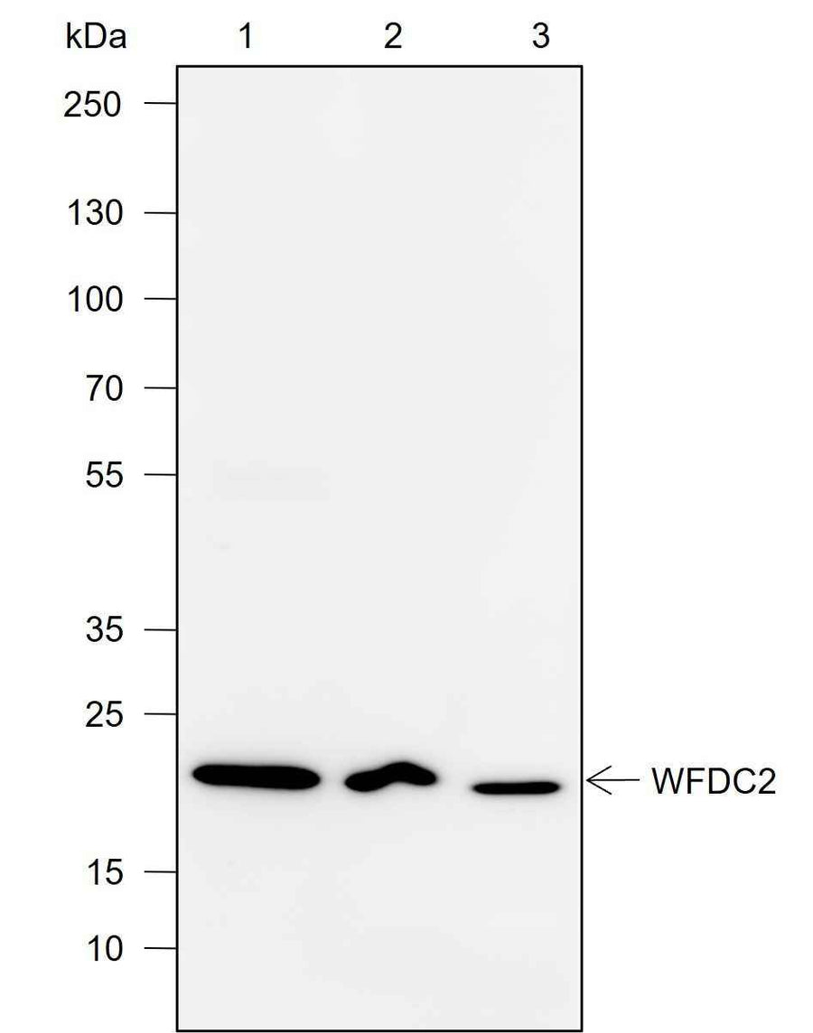 Anti-Human/Mouse WFDC2 Antibody [A736]