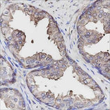 Anti-Human Calpastatin Antibody [A149]