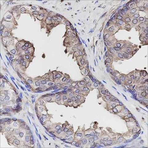 Anti-Human Calpastatin Antibody [A149] - ABMIUM