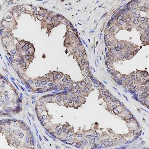 Anti-Human Calpastatin Antibody [A149] - ABMIUM