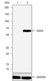 Anti-Human ADA2 Antibody [A727]