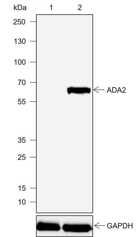 Anti-Human ADA2 Antibody [A727] - ABMIUM